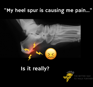 heel spur causing pain, Why heel spurs are not always the cause of heel pain