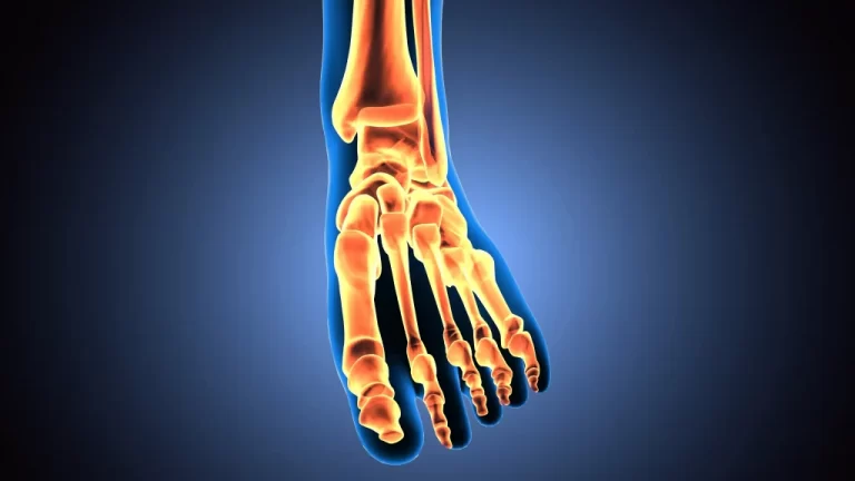 Foot and Ankle Arthritis Treatment | The Footwork Clinic Sydney CBD
